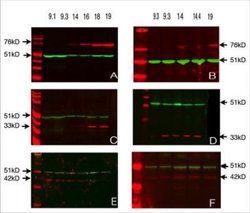 DAZL Antibody (DAZL3/11A) - Azide and BSA Free, Novus Biologicals 0.025